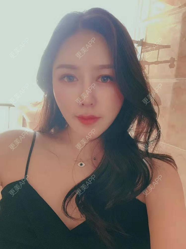 更美 - 更美用户dapPewZ45A的自体脂肪丰额头经验 | 自体脂肪丰额头 | 重庆