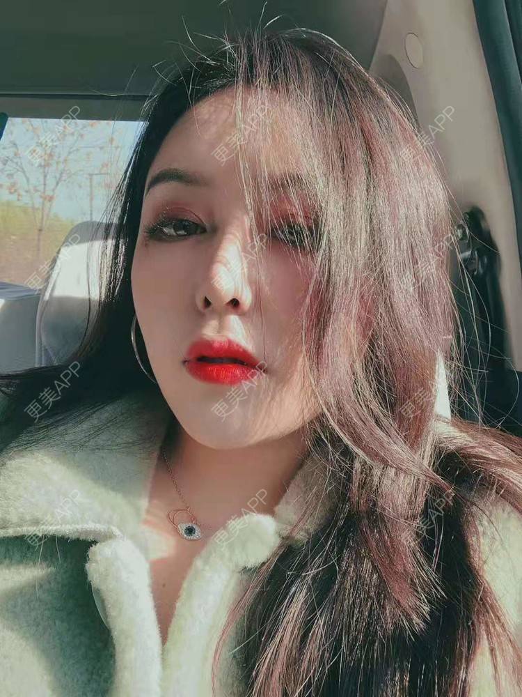 更美 - 更美用户dapPewZ45A的自体脂肪丰额头经验 | 自体脂肪丰额头 | 重庆