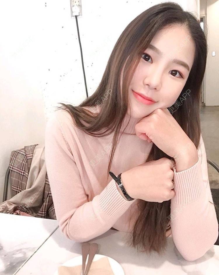 更美 - 更美用户EbSN7KpJNW的胶原蛋白淡化黑眼圈经验 | 郑州 | 胶原蛋白淡化黑眼圈