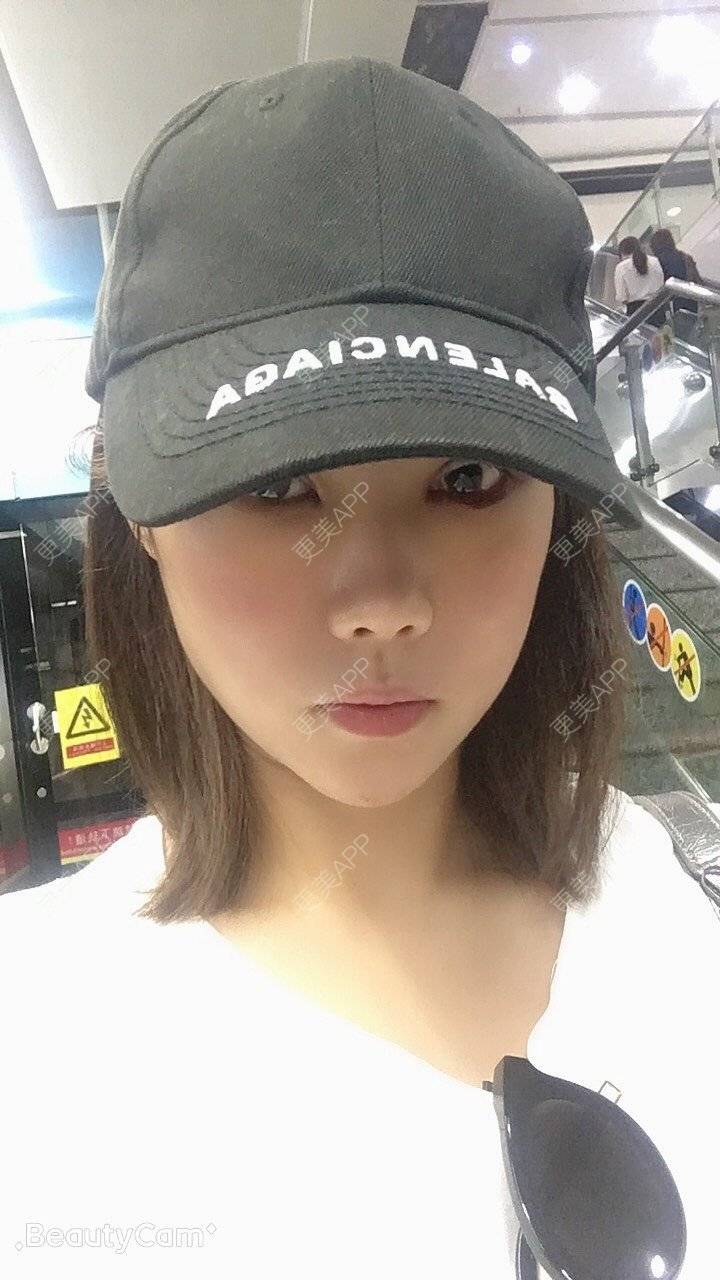 更美 - 更美用户Fbey21Pntj的祛斑祛色素经验 | 皮秒激光 | 改善肤质 | 广州 | 激光淡疤 | 激光淡斑