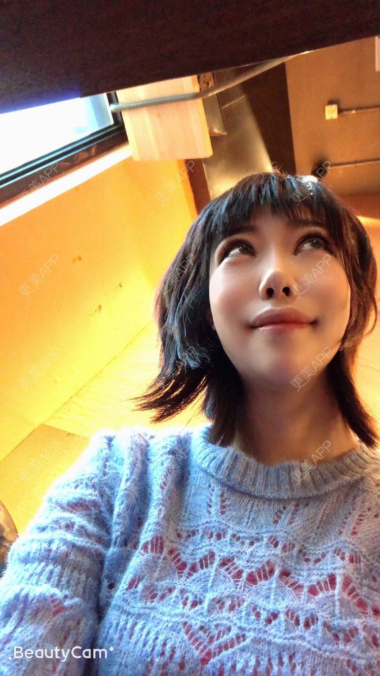 更美 - 🍬肉肉肉肉丝的下巴经验 | 下巴 | 硅胶垫下巴 | 哈尔滨