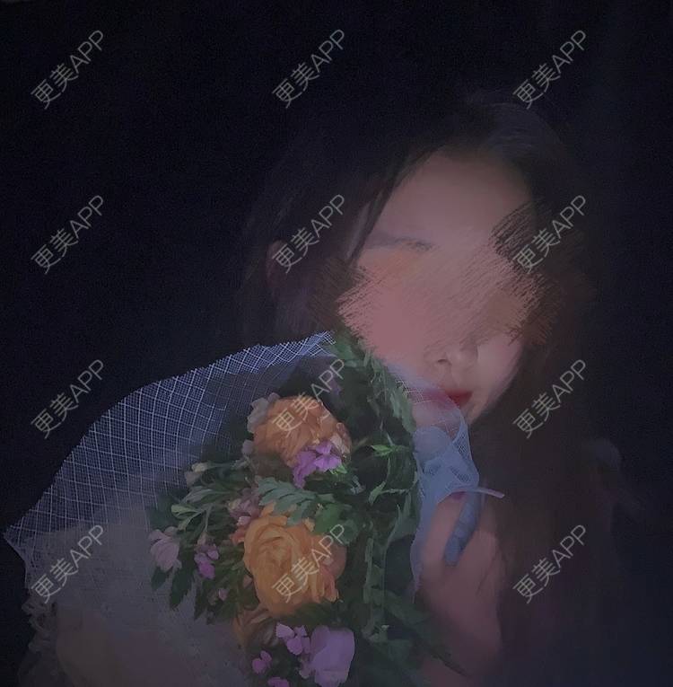 更美 - 更美用户WNHZo4gB1Y的阴蒂整形经验 | 阴蒂整形 | 上海