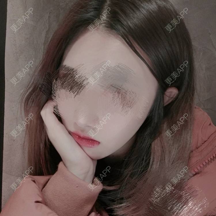 更美 - 更美用户WNHZo4gB1Y的阴蒂整形经验 | 上海 | 阴蒂整形
