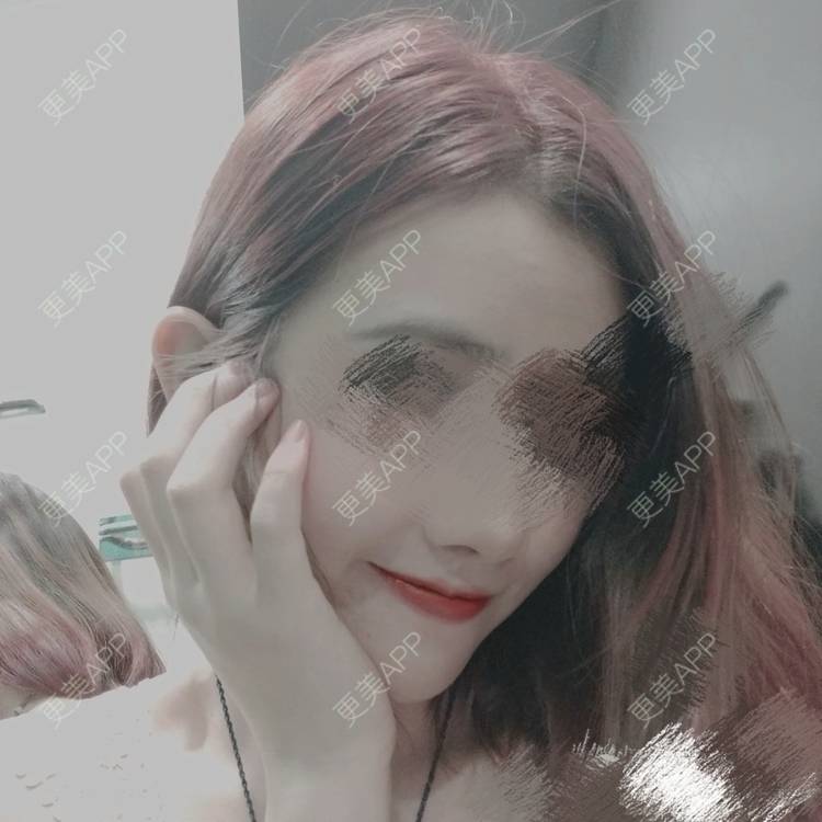 更美 - 更美用户WNHZo4gB1Y的阴蒂整形经验 | 上海 | 阴蒂整形