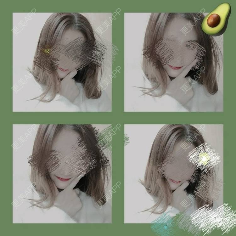 更美 - 更美用户WNHZo4gB1Y的阴蒂整形经验 | 上海 | 阴蒂整形