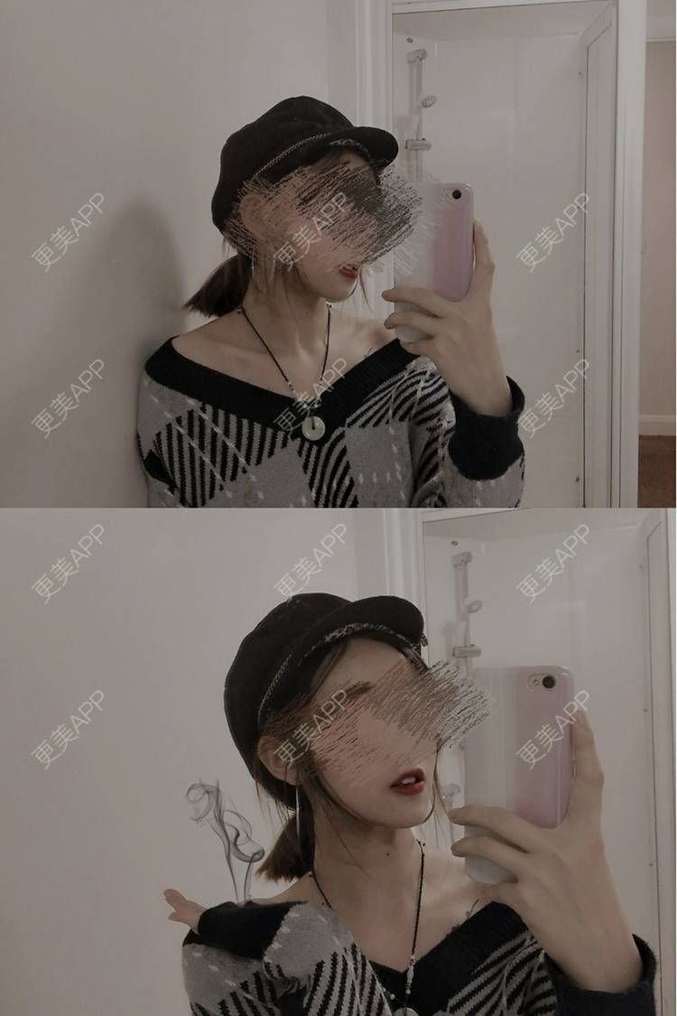 更美 - 更美用户WNHZo4gB1Y的阴蒂整形经验 | 上海 | 阴蒂整形