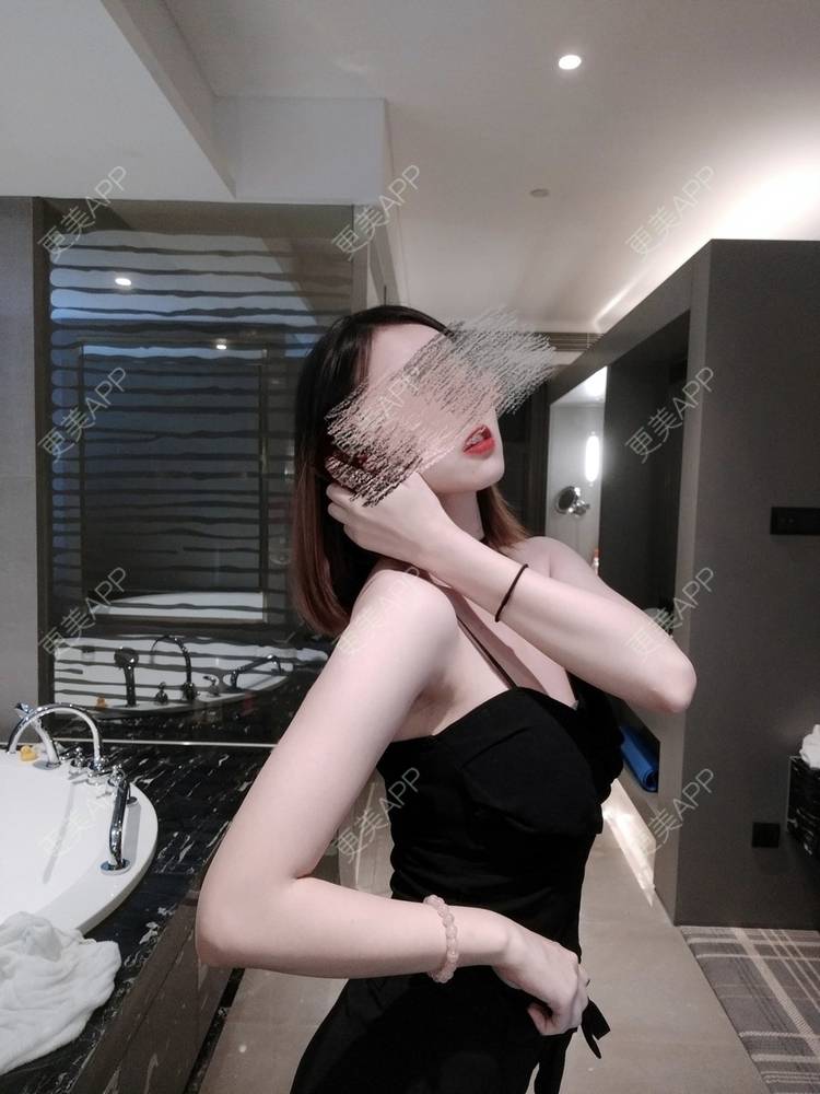更美 - 更美用户WNHZo4gB1Y的阴蒂整形经验 | 上海 | 阴蒂整形