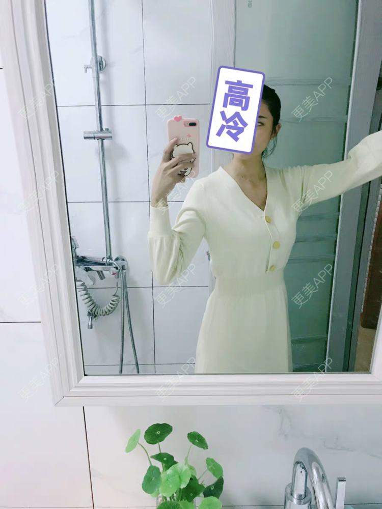 更美 - 雾，以类聚的阴蒂整形经验 | 上海 | 阴蒂整形