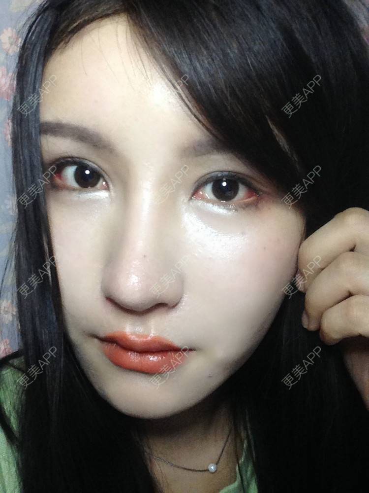 更美用户s65vm3fdnt的开外眼角日记