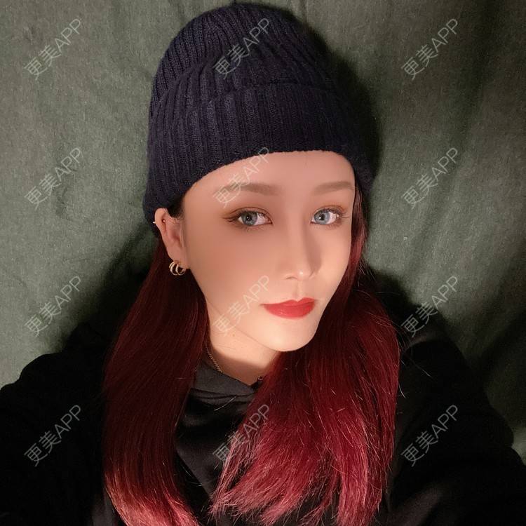 更美 - 端庄而又沉稳的我的鼻部多项经验 | 鼻部多项 | 鼻中隔软骨垫鼻头 | 自体软骨垫鼻尖 | 鼻小柱缩短 | 手术缩鼻头 | 膨体隆鼻 | 肋软骨隆鼻 | 鼻小柱延长 | 鼻部综合