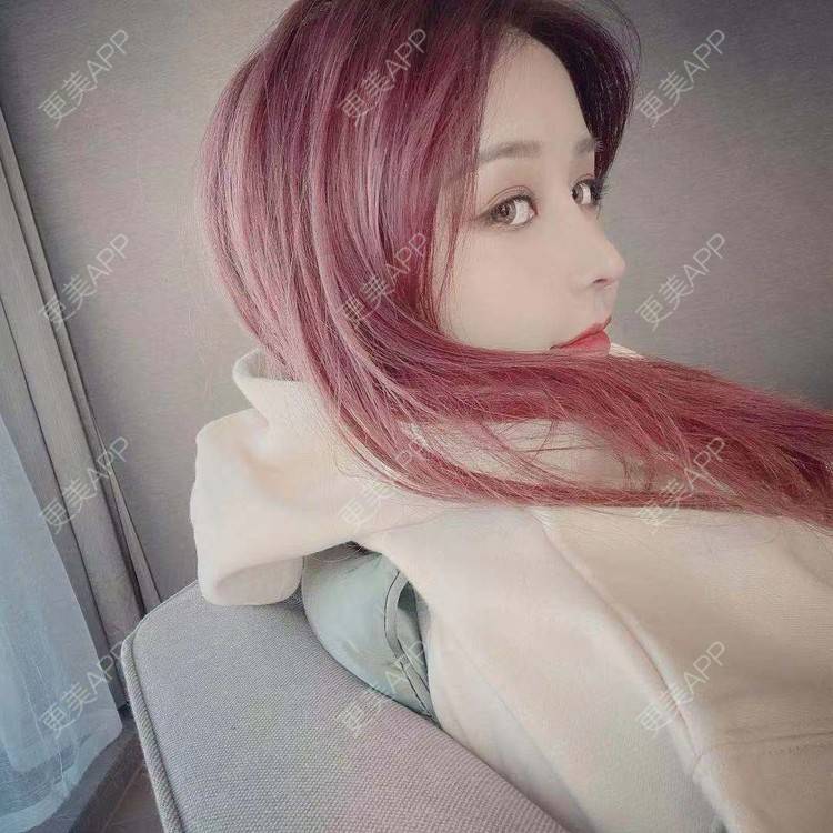 更美 - 端庄而又沉稳的我的鼻部多项经验 | 鼻部多项 | 鼻中隔软骨垫鼻头 | 自体软骨垫鼻尖 | 鼻小柱缩短 | 手术缩鼻头 | 膨体隆鼻 | 肋软骨隆鼻 | 鼻小柱延长 | 鼻部综合