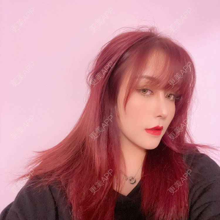 更美 - 端庄而又沉稳的我的鼻部多项经验 | 鼻部多项 | 鼻中隔软骨垫鼻头 | 自体软骨垫鼻尖 | 鼻小柱缩短 | 手术缩鼻头 | 膨体隆鼻 | 肋软骨隆鼻 | 鼻小柱延长 | 鼻部综合