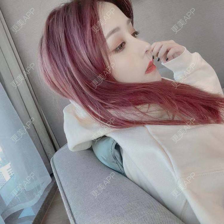 更美 - 端庄而又沉稳的我的鼻部多项经验 | 鼻部多项 | 鼻中隔软骨垫鼻头 | 自体软骨垫鼻尖 | 鼻小柱缩短 | 手术缩鼻头 | 膨体隆鼻 | 肋软骨隆鼻 | 鼻小柱延长 | 鼻部综合