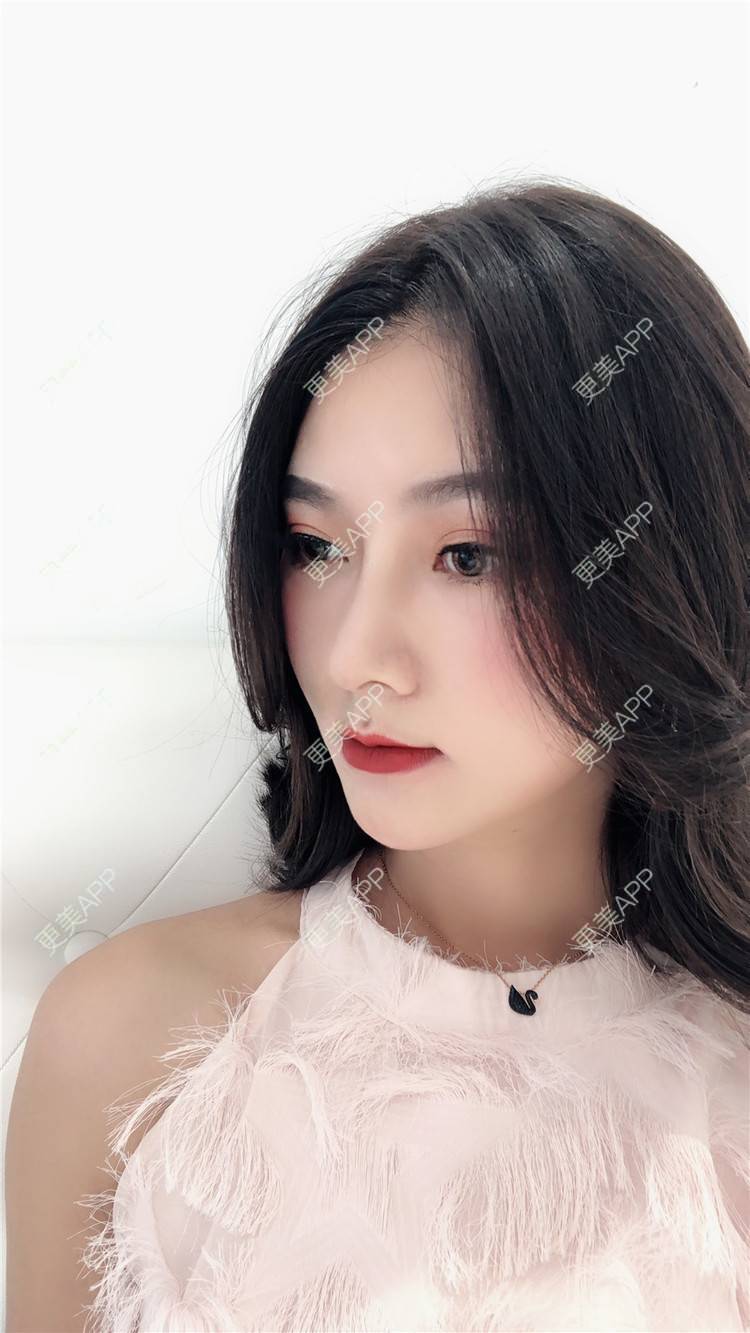 无边萧萧的肋软骨隆鼻日记