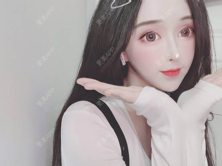 更美 - 小精玲的假体隆胸经验 | 视频日记 | 假体隆胸 | 深圳