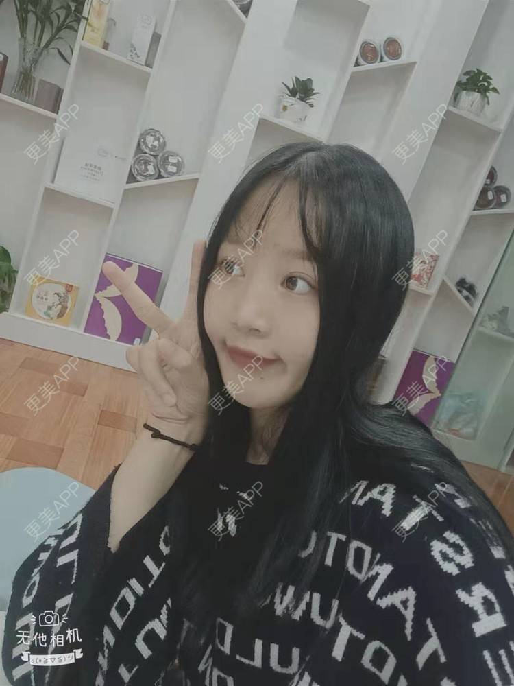 更美 - 更美用户cZDofR1cWa的双眼皮修复经验 | 成都 | 双眼皮修复