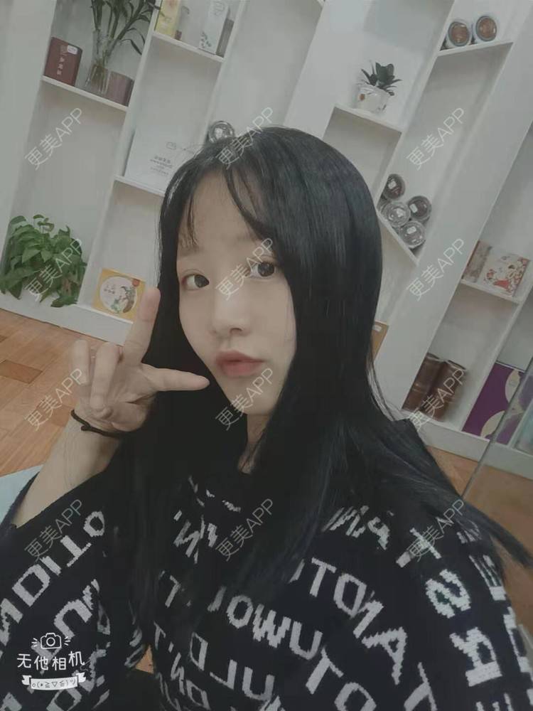 更美 - 更美用户cZDofR1cWa的双眼皮修复经验 | 成都 | 双眼皮修复