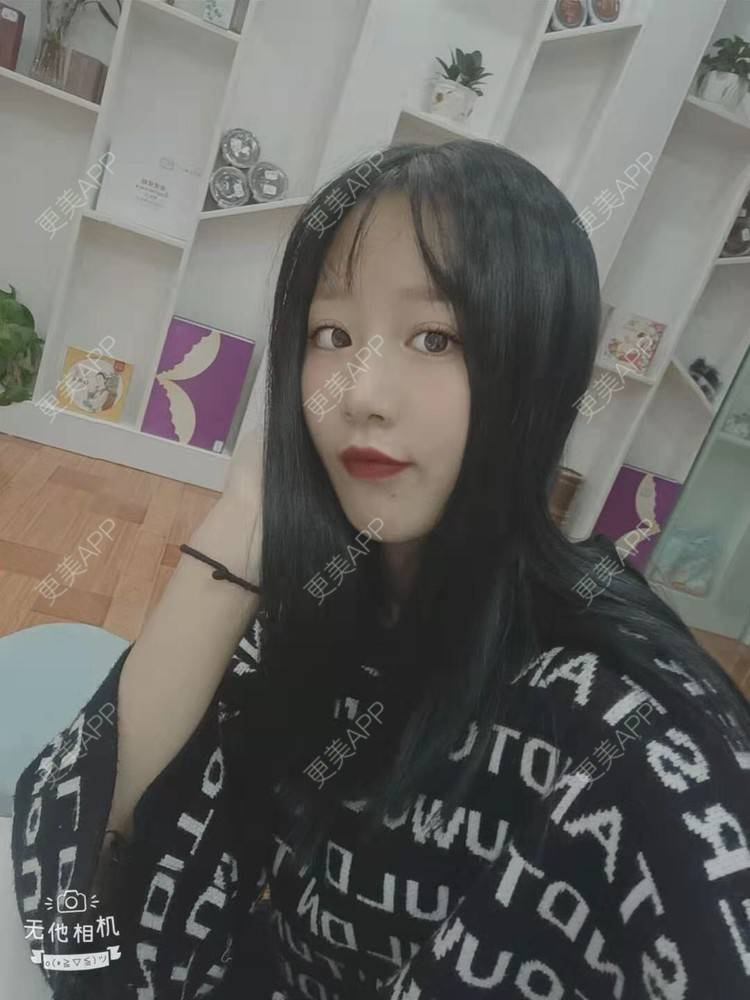 更美 - 更美用户cZDofR1cWa的双眼皮修复经验 | 成都 | 双眼皮修复