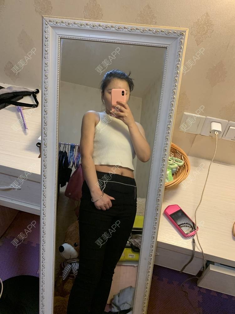 更美 - 李文雅施的吸脂去副乳经验 | 吸脂去副乳 | 吸脂 | 上海