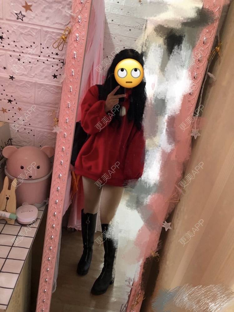 更美 - 更美用户hNU28EYmMA的激光脱发际线经验 | 激光脱发际线 | 上海