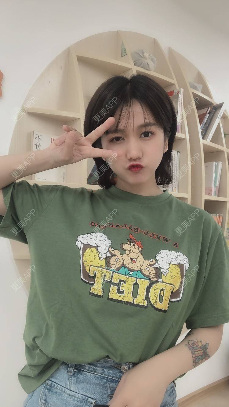 更美 - 阳海斌 医生的埋线提升经验 | 埋线提升 | 视频日记 | 佛山