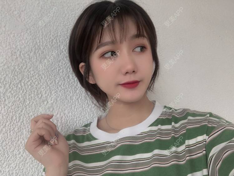 更美 - 阳海斌 医生的埋线提升经验 | 埋线提升 | 视频日记 | 佛山