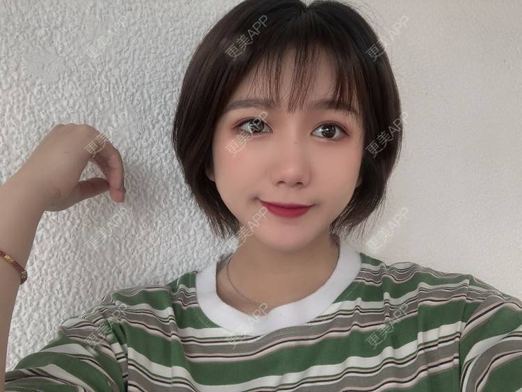 更美 - 阳海斌 医生的埋线提升经验 | 埋线提升 | 视频日记 | 佛山