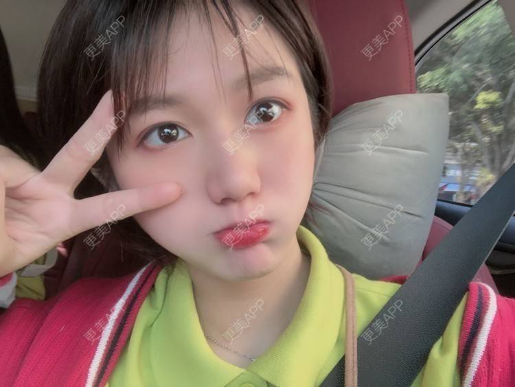 更美 - 阳海斌 医生的埋线提升经验 | 埋线提升 | 视频日记 | 佛山