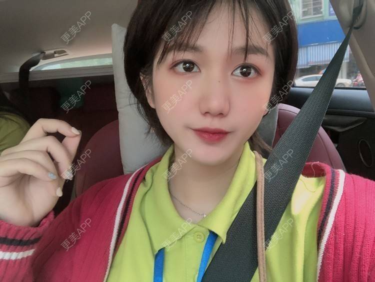 更美 - 阳海斌 医生的埋线提升经验 | 埋线提升 | 视频日记 | 佛山