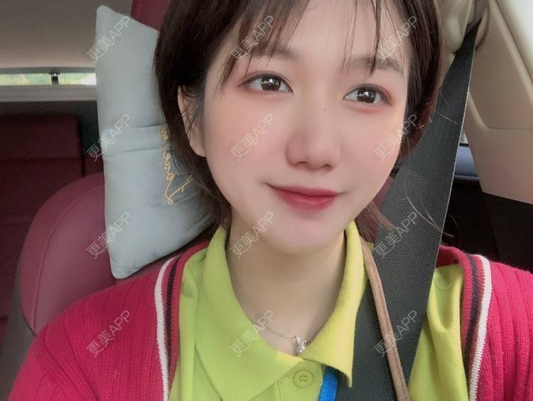 更美 - 阳海斌 医生的埋线提升经验 | 埋线提升 | 视频日记 | 佛山