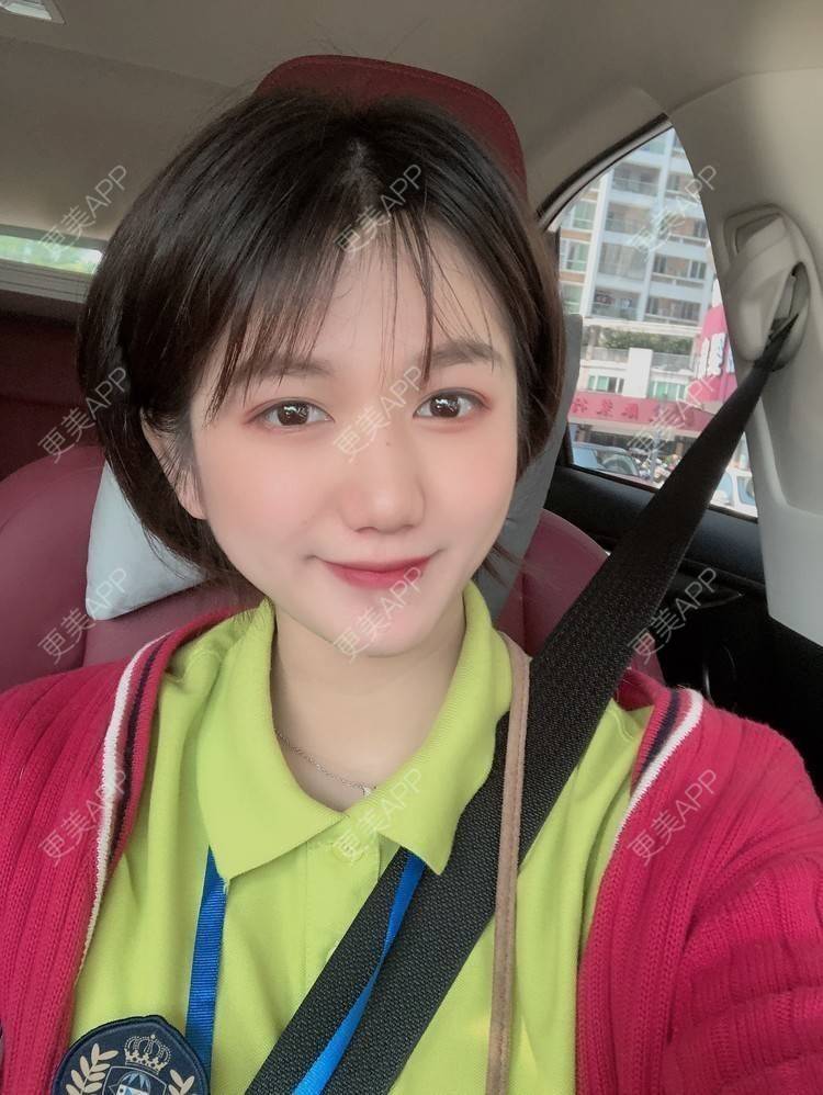 更美 - 阳海斌 医生的埋线提升经验 | 埋线提升 | 视频日记 | 佛山