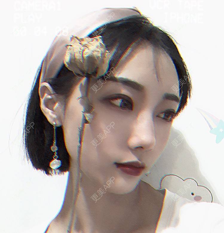 更美 - 更美用户ZYq2ZmuobY的自体脂肪丰苹果肌经验 | 自体脂肪丰面颊 | 自体脂肪丰苹果肌 | 自体脂肪垫下巴 | 自体脂肪丰额头 | 自体脂肪丰太阳穴 | 武汉 | 自体脂肪全面部填充 | 耳软骨隆鼻