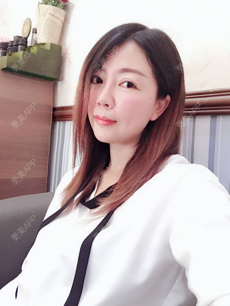 更美 - Mica-M的埋线除皱经验 | 埋线除皱 | 成都