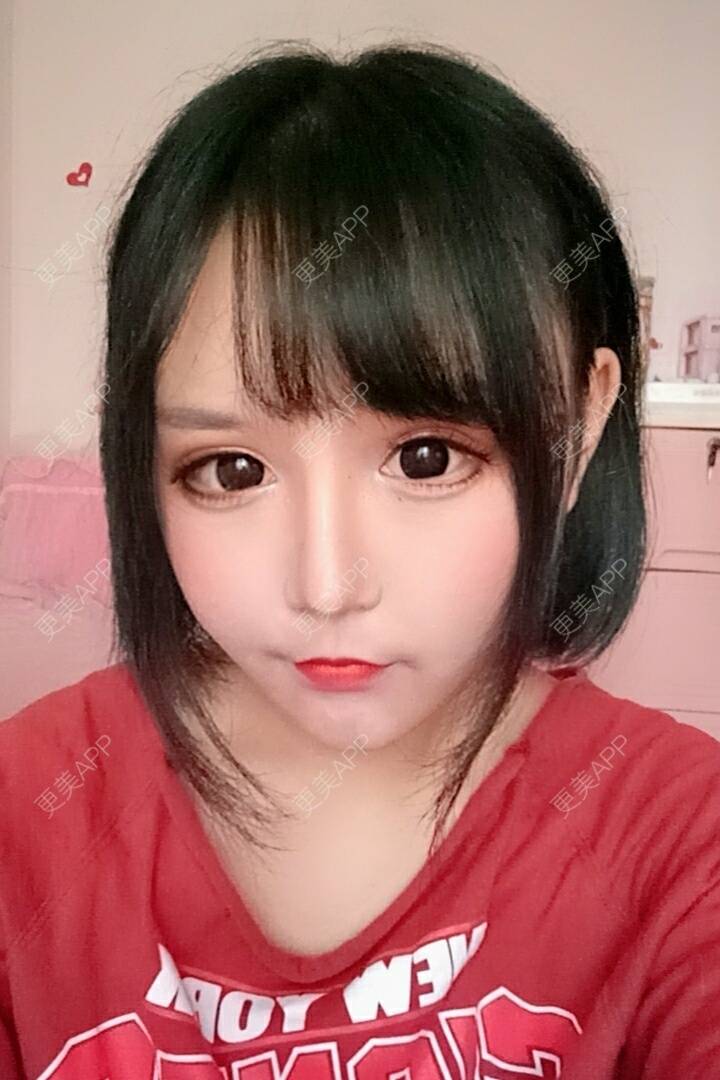 芭比芭比啵的眼综合日记