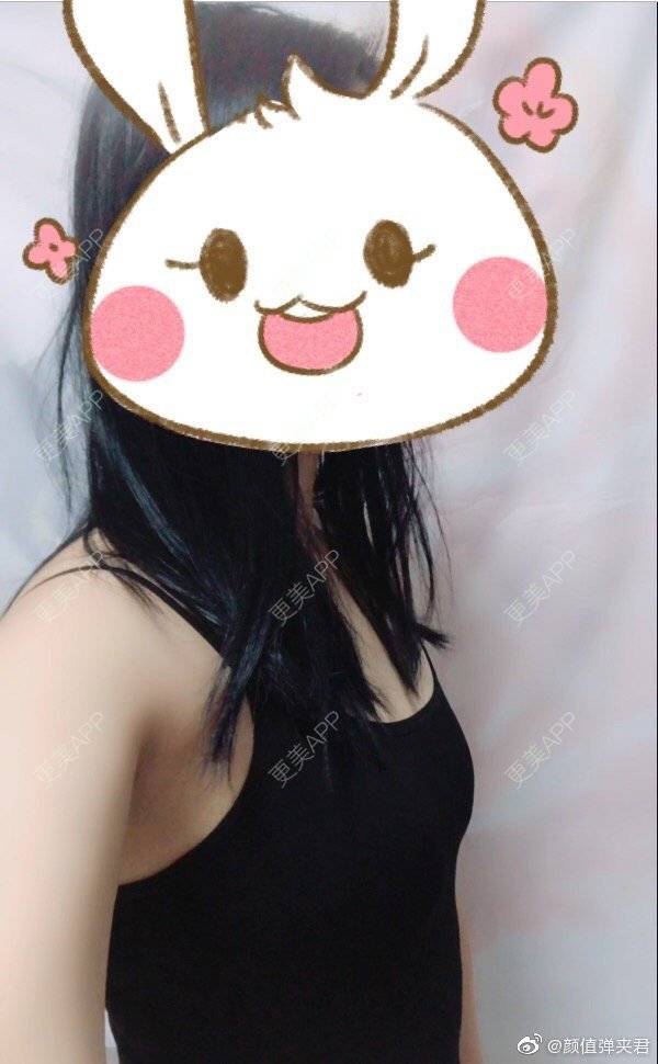 更美 - 土猪土猪猪猪猪的假体隆胸经验 | 假体隆胸