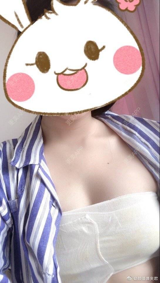 更美 - 土猪土猪猪猪猪的假体隆胸经验 | 假体隆胸