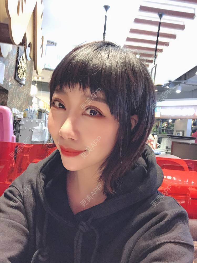 更美 - 🍬肉肉肉肉丝的下巴经验 | 下巴 | 硅胶垫下巴 | 哈尔滨