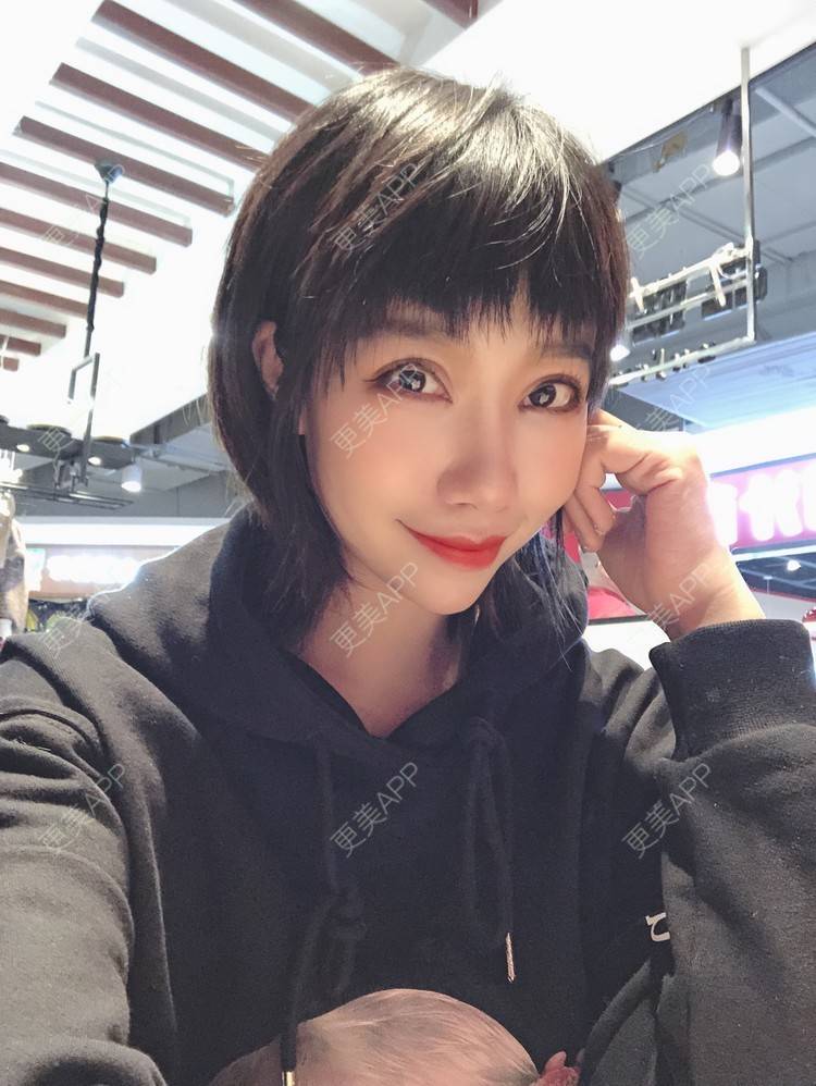 更美 - 🍬肉肉肉肉丝的下巴经验 | 下巴 | 硅胶垫下巴 | 哈尔滨