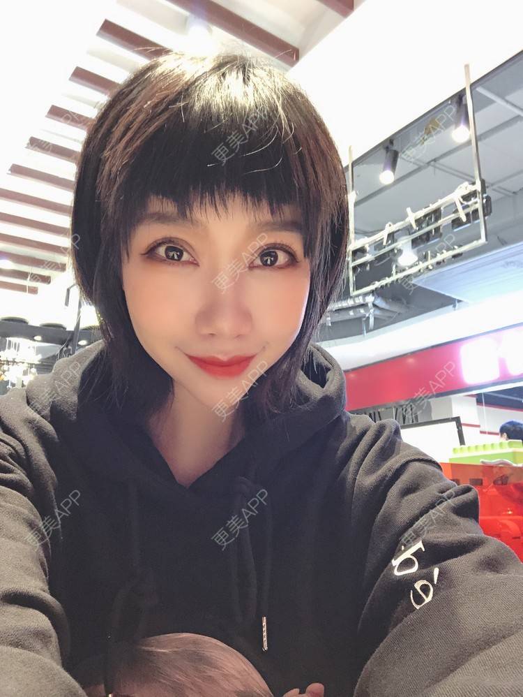 更美 - 🍬肉肉肉肉丝的下巴经验 | 下巴 | 硅胶垫下巴 | 哈尔滨
