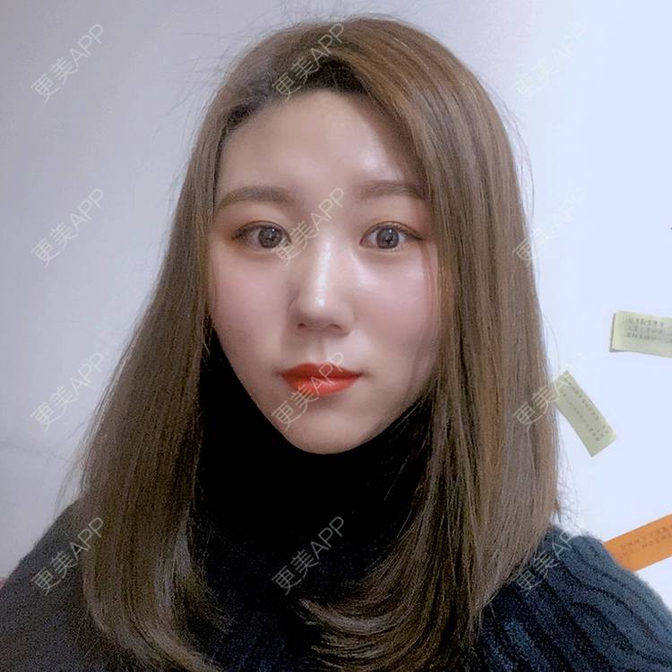 更美 - 更美用户BCnGAWvUOJ的胶原蛋白注射经验 | 胶原蛋白注射 | 视频日记 | 沈阳