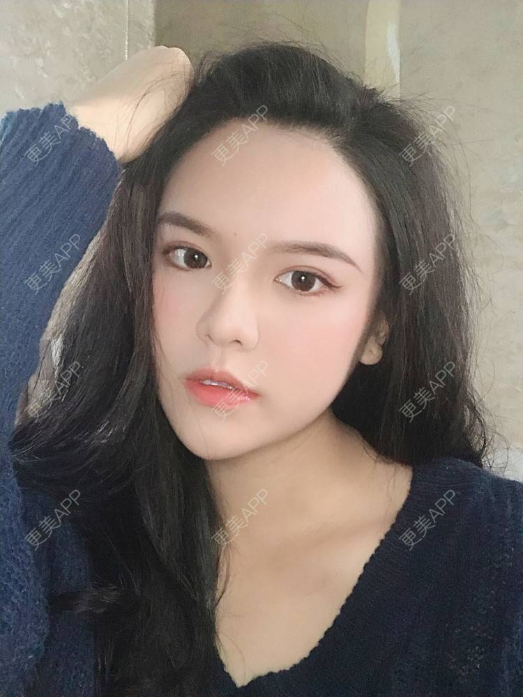 更美 - 更美用户X4LuQyEyHb的眼部多项经验 | 北京 | 眼部多项 | 视频日记