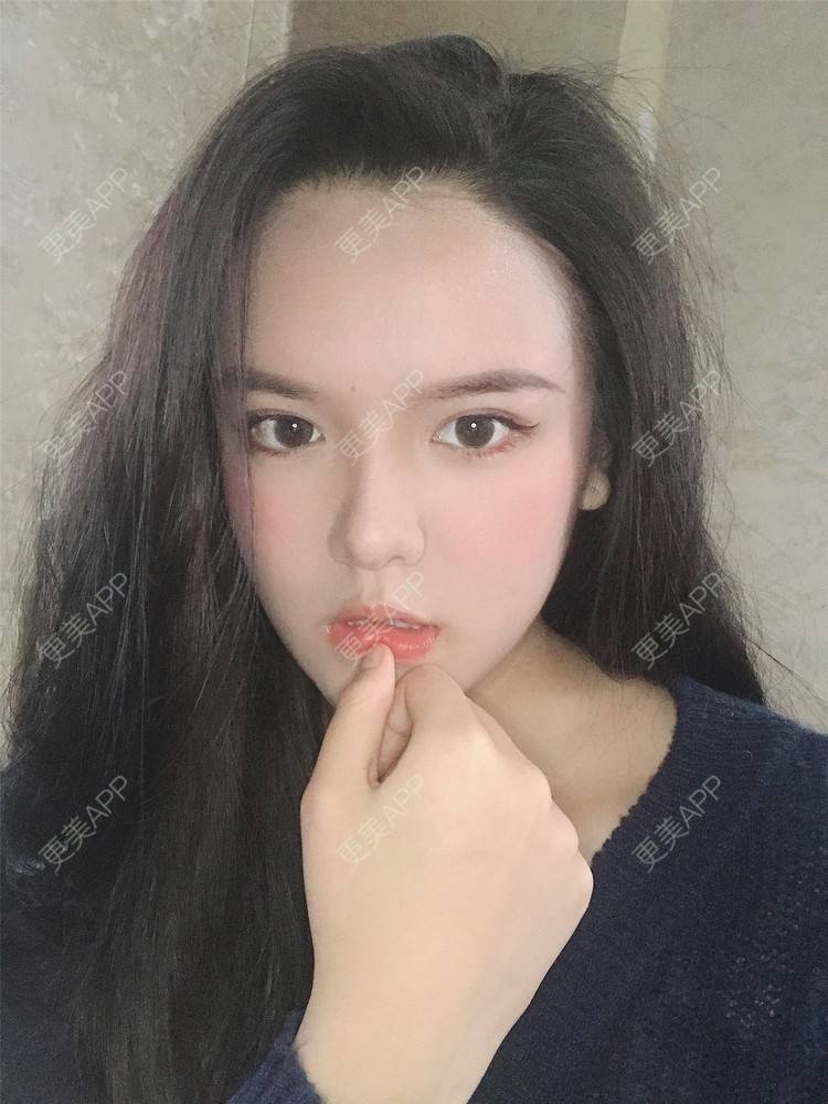 更美 - 更美用户X4LuQyEyHb的眼部多项经验 | 北京 | 眼部多项 | 视频日记