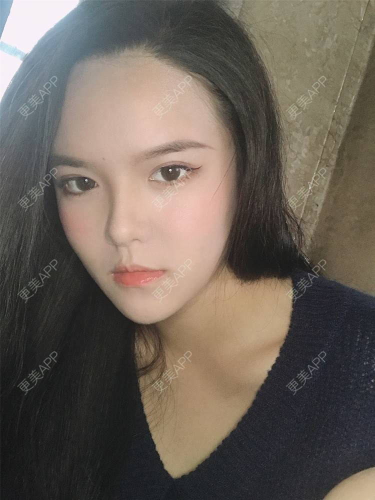 更美 - 更美用户X4LuQyEyHb的眼部多项经验 | 北京 | 眼部多项 | 视频日记