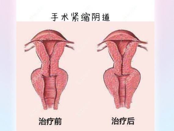 更美 - 侯智慧的经验 | 更美研究所 | 北京
