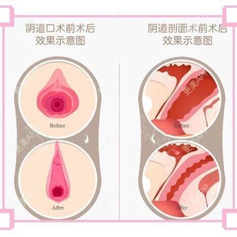 更美 - 侯智慧的经验 | 更美研究所 | 北京