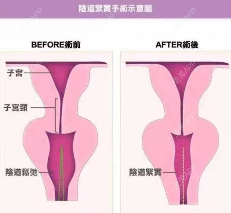 更美 - 侯智慧的经验 | 更美研究所 | 北京
