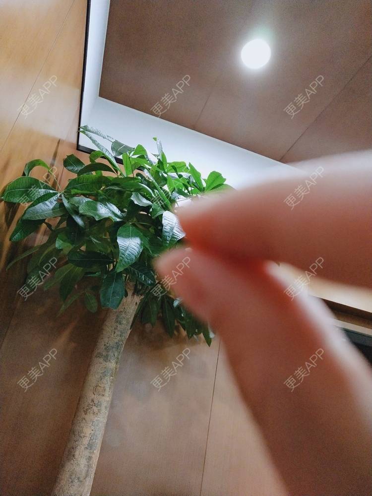 更美 - 更美用户oxU0xpBRZG的激光脱发际线经验 | 激光脱发际线 | 上海
