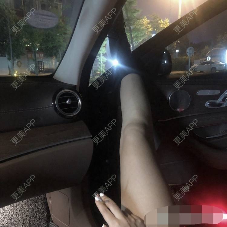 更美 - 更美用户oxU0xpBRZG的激光脱发际线经验 | 激光脱发际线 | 上海