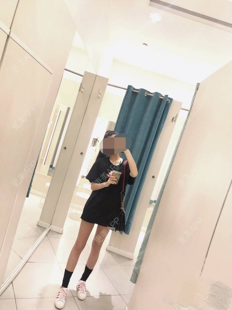 更美 - 更美用户oxU0xpBRZG的激光脱发际线经验 | 激光脱发际线 | 上海