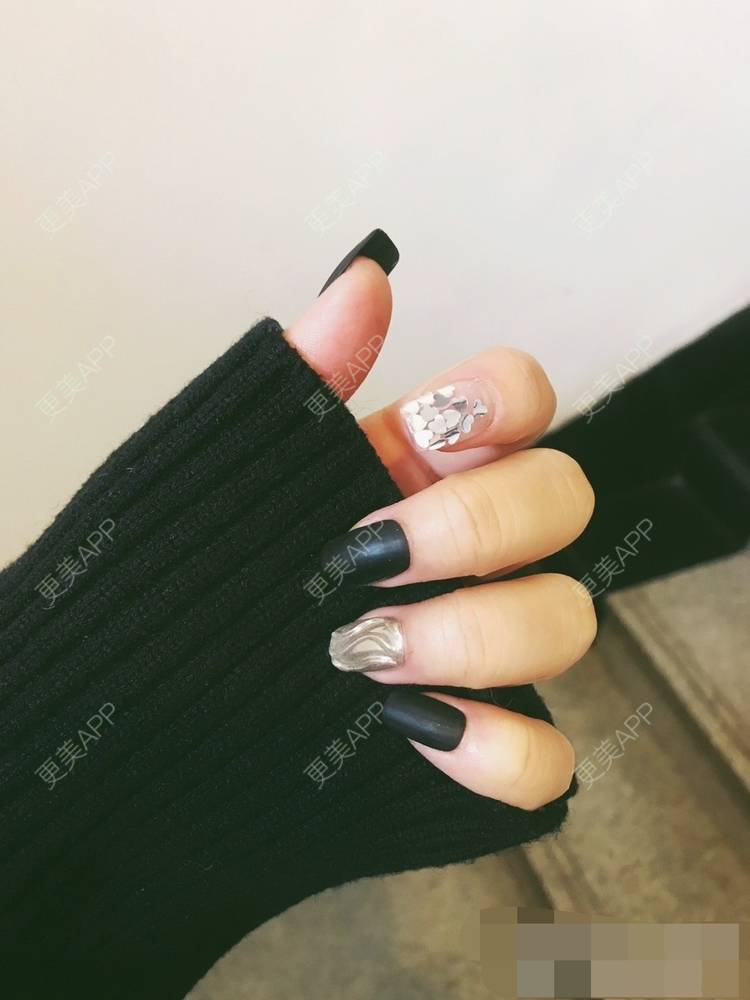 更美 - 更美用户oxU0xpBRZG的激光脱发际线经验 | 激光脱发际线 | 上海